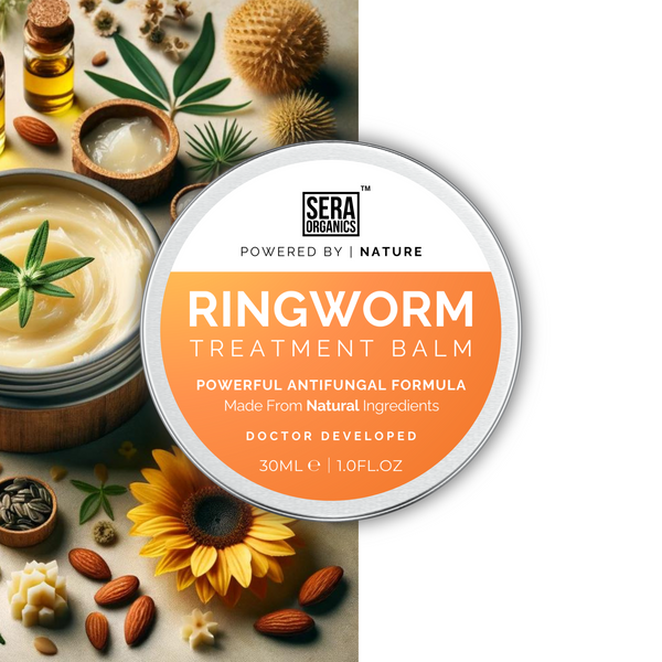 Ringworm Herbal Balm