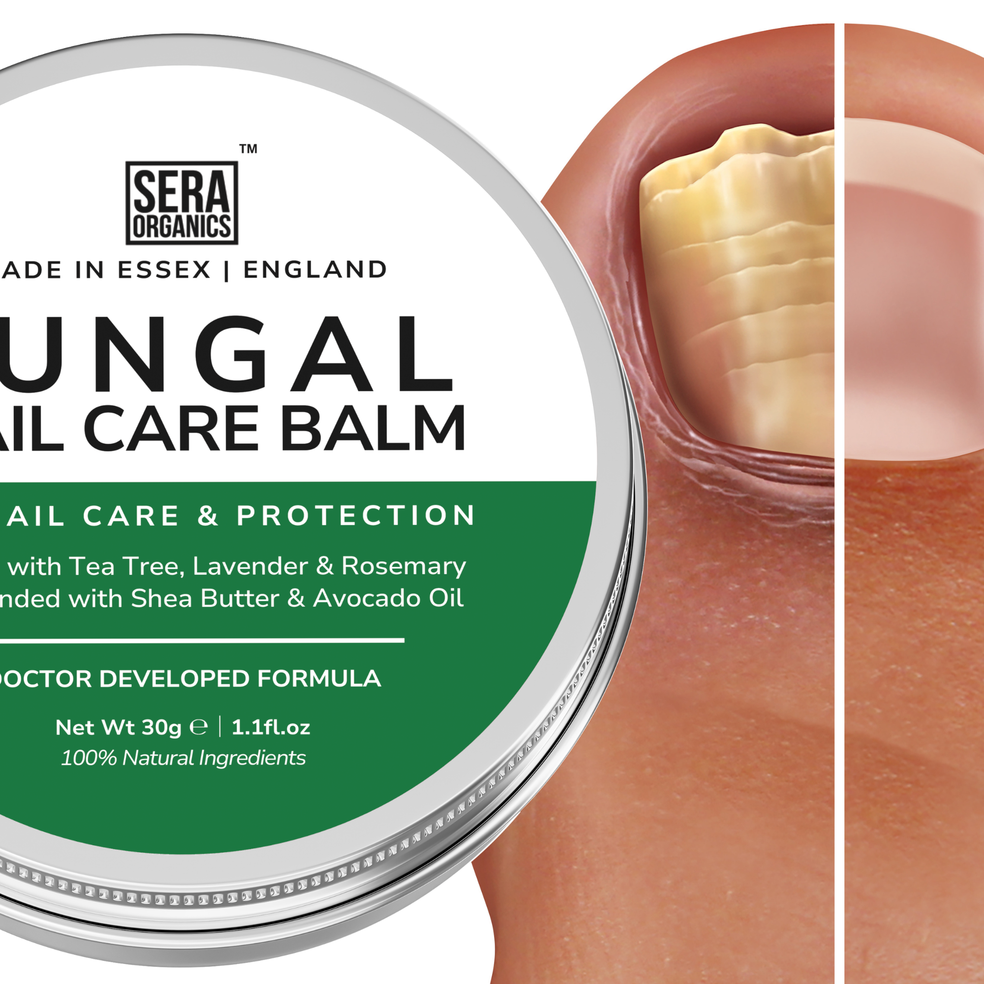 Fungal Nail Care Balm | Natural Tea Tree & Shea Butter Formula