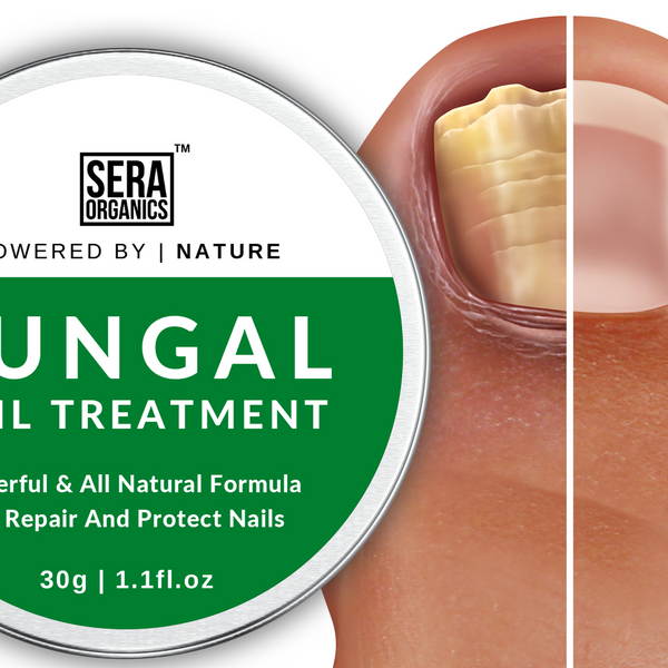 Fungal Nail Rescue Cream